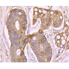 Anti-NaV1.7 antibody [1D6]
