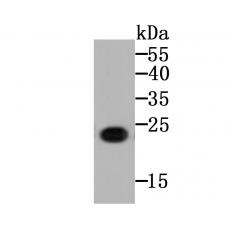 Anti-CD130 antibody [B11-B9-A8]