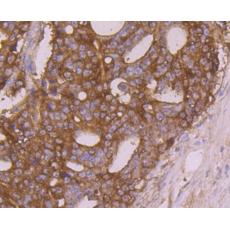 Anti-Calreticulin antibody [7B1]