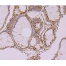 Anti-Calreticulin antibody [7B2]