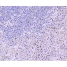 Anti-Glucocorticoid Receptor alpha antibody [3F1]