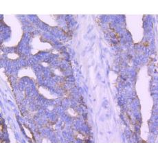 Anti-AMACR/P504S antibody [6F5]