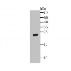 Anti-GPX1 antibody [A6-C0-B9]