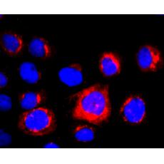 Anti-NGAL antibody [AH22-11]