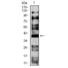 Anti-CD191 antibody [8E10F9]