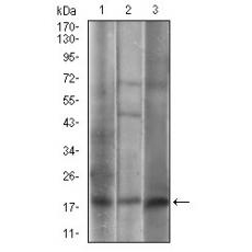Anti-CAV2 antibody [2E-9E]