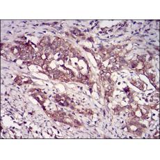 Anti-CSNK2B antibody [F3-F12]