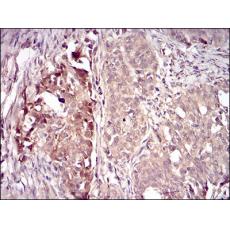 Anti-VIL1 antibody [G11-5E]