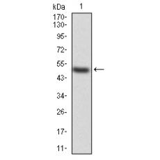 Anti-KBTBD8 antibody [6G-8A]