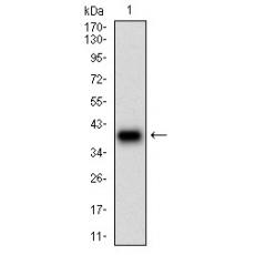 Anti-DSG3 antibody [11G-2C]
