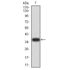 Anti-ACVR1 antibody [C11-E2]