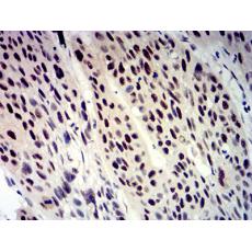 Anti-BTRC antibody [D8-C5]