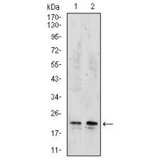 Anti-NME2 antibody [A8-G7]