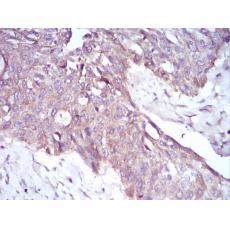 Anti-PKHD1 antibody [A1-G12]