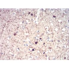 Anti-CALB2 antibody [H1-F5]