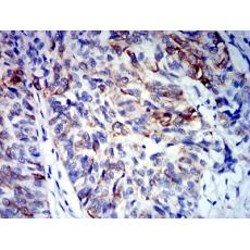 Anti-CD64 antibody [5F5F8]