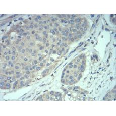 Anti-MECP2 antibody [5B-9H]