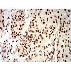 Anti-UHRF1 antibody [B1-A1]