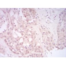 Anti-SIRT7 antibody [G10-E2]