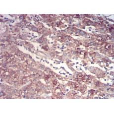 Anti-TTR antibody [C5-E10]