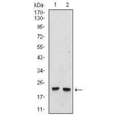 Anti-UBE2C antibody [5D-3F]