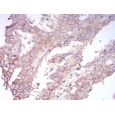 Anti-SK2 antibody [E1-C5]