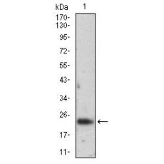Anti-FTL antibody [E4-E10]