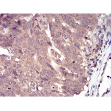 Anti-SLINGSHOT-1L antibody [G9-C11]