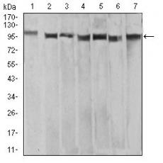 Anti-XRN2 antibody