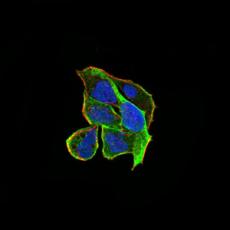 Anti-RND3 antibody