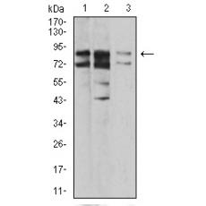 Anti-IL1RAPL1 antibody