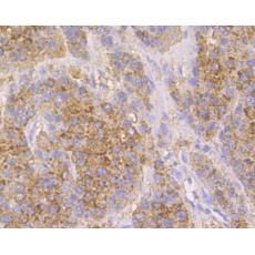 Anti-Cathepsin D antibody [13F4]