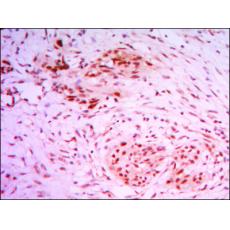 Anti-KDM4A antibody [E7-H1]