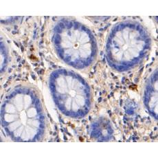 Anti-Myeloperoxidase antibody [A1F3]