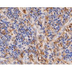 Anti-Thymidine Phosphorylase antibody [A1A8]