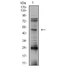 Anti-AP2 beta antibody [G1-F7]