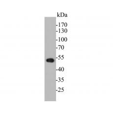 Anti-Cytokeratin 17 antibody [A2B9]