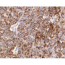 Anti-Cytokeratin 17 antibody [A2B10]