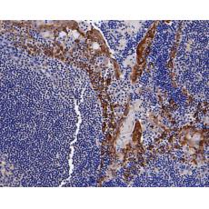Anti-Cytokeratin 14 antibody [A2C12]