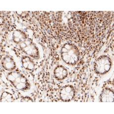Anti-MTA2 antibody [17A1]