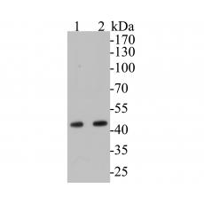Anti-Aspartate Aminotransferase antibody [A2D6]