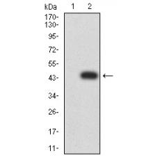 Anti-IL1R1 antibody [D12-D2]