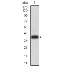 Anti-ADAMTS1 antibody [E6-C12]