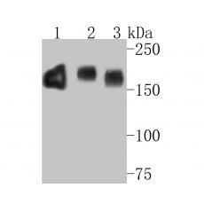 Anti-EGFR antibody [7-F2-F8]