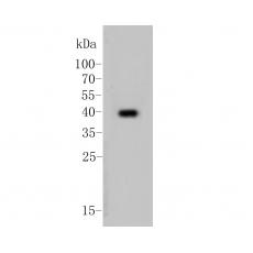 Anti-Cytokeratin 19 antibody [A3D5]