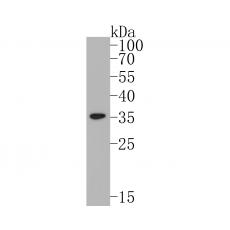 Anti-MCU antibody [A2E11]