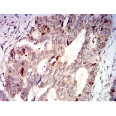 Anti-AURKA antibody [A4-8D]
