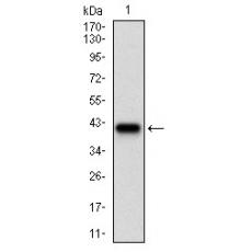 Anti-SERPINA3 antibody [G3-C11]