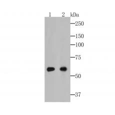 Anti-Cytokeratin 5+6 antibody [A2A12]