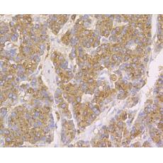 Anti-Cathepsin D antibody [13F4]